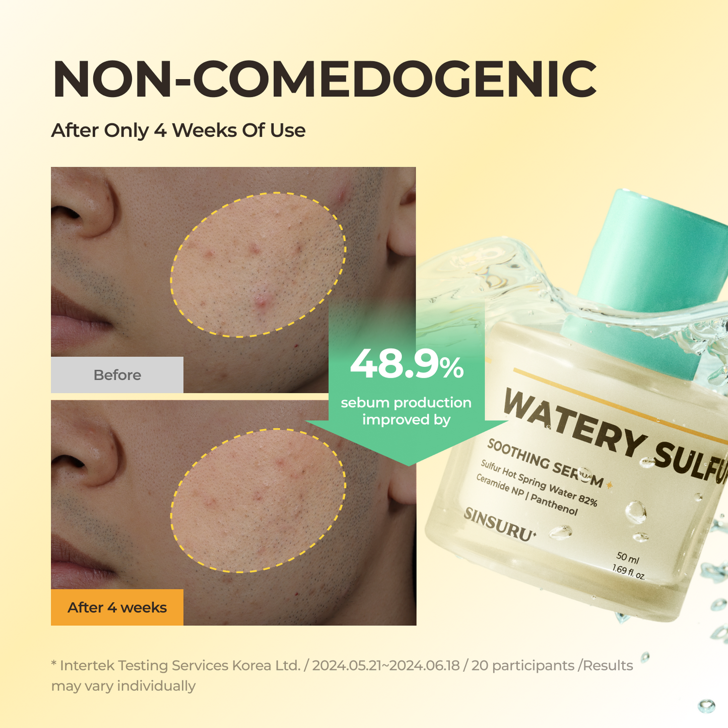 Watery Sulfur 82 Soothing Serum