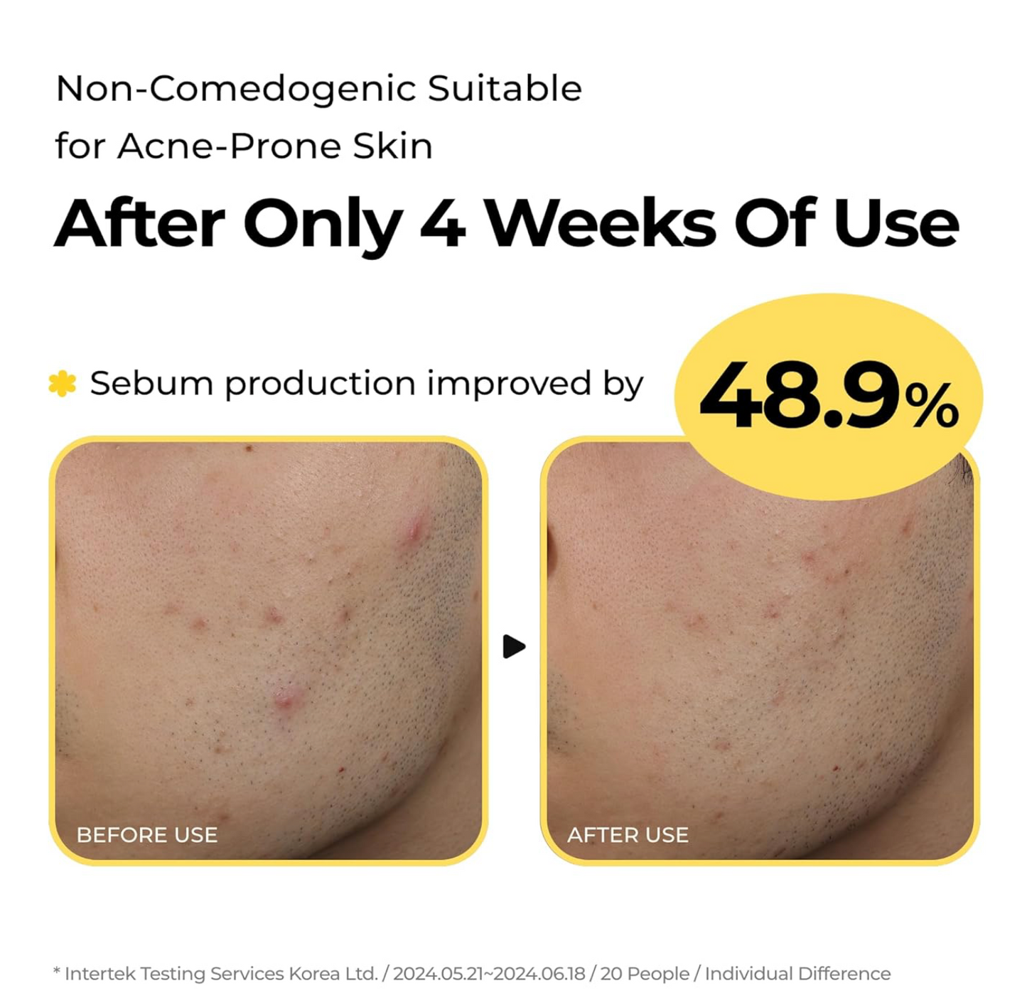 Sulfur Hot Spring Water 82% Soothing Serum