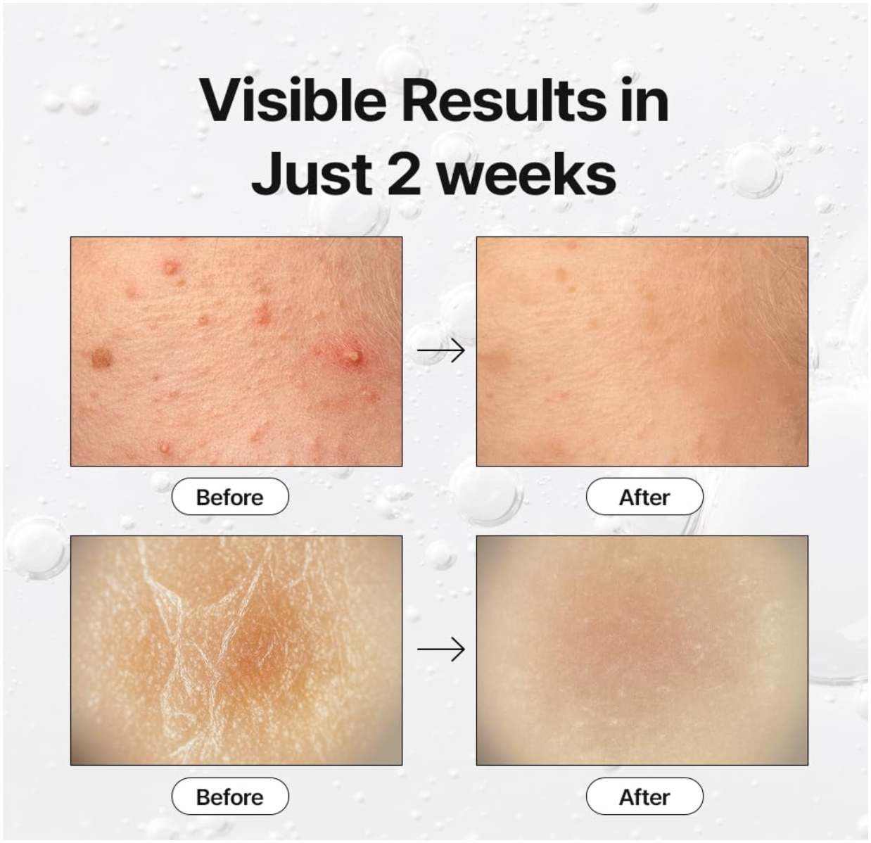 Cellinto Pico Tightening Exosome Ampoule